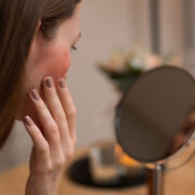 敏感肌症狀有哪些